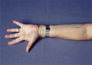 Zähler = Nenner Vorschau